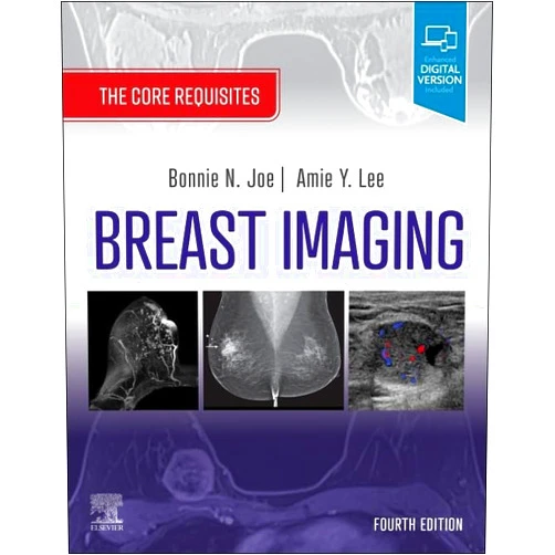 Bonnie N. Joe MD PhD,Amie Y. Lee MD Breast Imaging: The Core Requisites