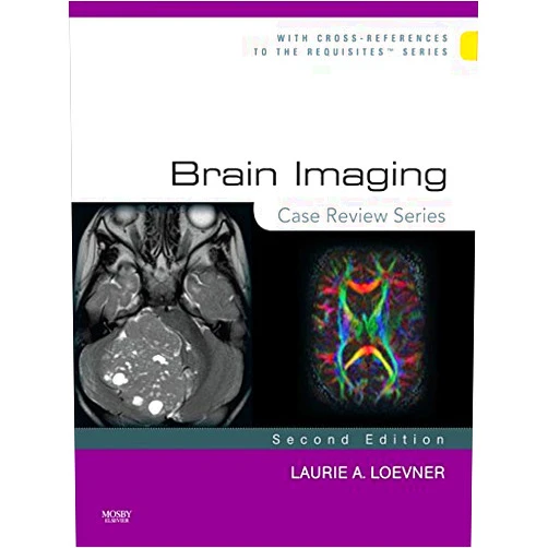By Laurie A. Loevner (Author) Format: Kindle Edition Brain Imaging: Case Review Series E-Book