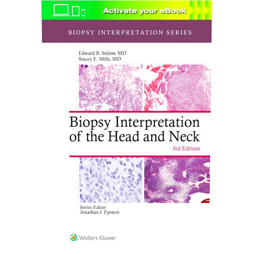 Edward B. Stelow MD,Stacey Mills Biopsy Interpretation of the Head and Neck (Biopsy Interpretation Series)