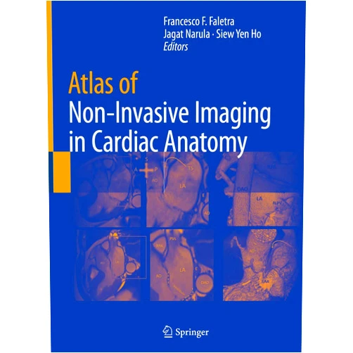 Francesco F. Faletra,Jagat Narula,Siew Yen Ho Atlas of Non-Invasive Imaging in Cardiac Anatomy