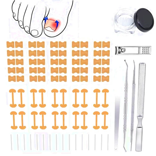 Gemsanva Ingrown Toenail Corrector Set with Correction Strips,Professional Ingrown Toenail Tool kit,Curved Toenails Corrector Patch,For Home Pedicure Care