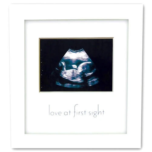 Green Pollywog | Sonogram Picture Frame | White Frame | Ultrasound Frame | Pregnancy Gifts for First Time Moms | Baby Ultrasound Picture Frame | Gifts for Parents/Grandparents | Nursery Decor
