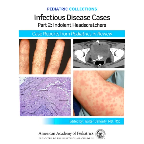American Academy of Pediatrics (AAP) Pediatric Collections: Infectious Disease Cases: Part 2: Indolent Head Scratchers: Case Reports from Pediatrics in Review