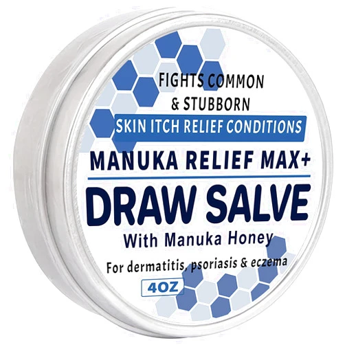KOKOMAANE Max Strength Treat Natural Organic Manuka Honey Cream Ointment, Soothing Relief for Dry, Heat Rash, Hidradenitis, Itchy, Eczema, Psoriasis, Leg, Belly, Armpit, Foot, Hand, Irritable Skin For All Ages