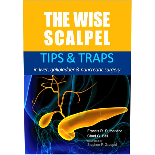 Francis Sutherland,Chad G. Ball The Wise Scalpel: Tips & Traps in liver, gallbladder & pancreatic surgery
