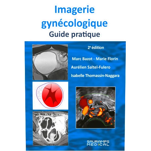 French Edition by Marc Bazot (Author), Marie FLORIN (Author), Aurélien SALTEL-FULERO (Author), Isabelle Thomassin-Naggara (Author) & 1 more Imagerie gynécologique. Guide pratique 2ed
