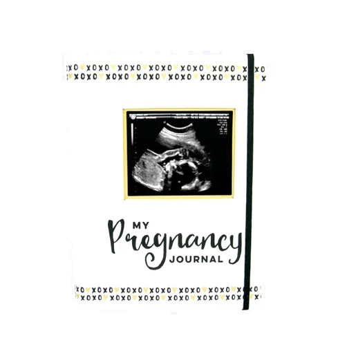 Pearhead My Pregnancy Journal - 74-Page Memory Book and Photo Album, Gender Neutral Planner for Expecting Moms, Includes Milestone Sections and Ultrasound Photo Insert
