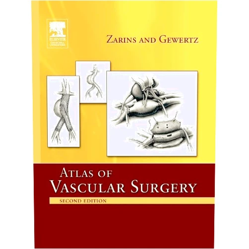 Christopher K. Zarins MD,Bruce L. Gewertz MD Atlas of Vascular Surgery - Paperback Edition