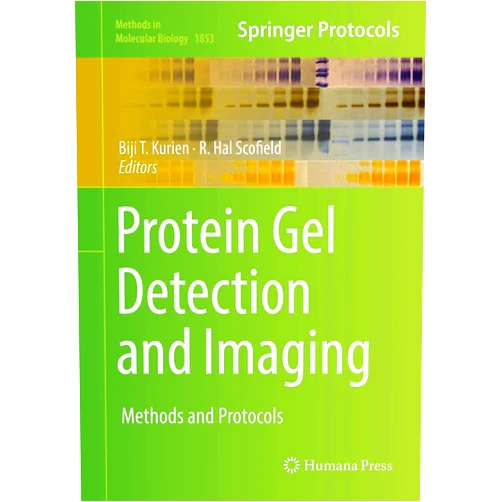Biji T. Kurien,R. Hal Scofield Protein Gel Detection and Imaging: Methods and Protocols (Methods in Molecular Biology, 1853)