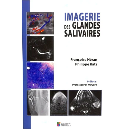 Philippe Katz,Françoise Héran IMAGERIE DES GLANDES SALIVAIRES
