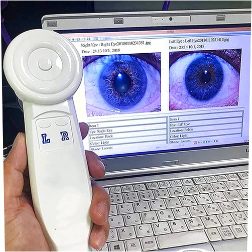 HEAXIY Iris Analyzer Camera, High Resolution Iriscope Eye Camera with HD 30x Iris Lens & Analysis Software, Precise Iridology Camera for Detailed Eye Examination