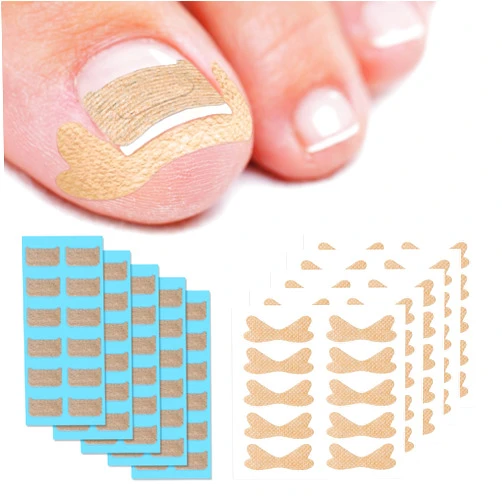 BEZOX 60Pcs Breathable Ingrown Toenail Corrector Patches and 50Pcs Ingrown Toenail Stickers - Professional Ingrown Toe Nail Treatment Tape for Pain Relief and Correction