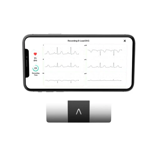 AliveCor KardiaMobile 6-Lead Personal EKG Monitor – Six Views of The Heart – Detects AFib and Irregular Arrhythmias – Instant Results in 30 Seconds – Works with Most Smartphones - FSA/HSA Eligible
