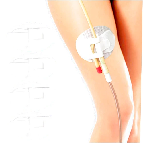 Gadget Beyond Foley Catheter Stabilization Device, Urinary Leg Bag Holder, Pack of 4