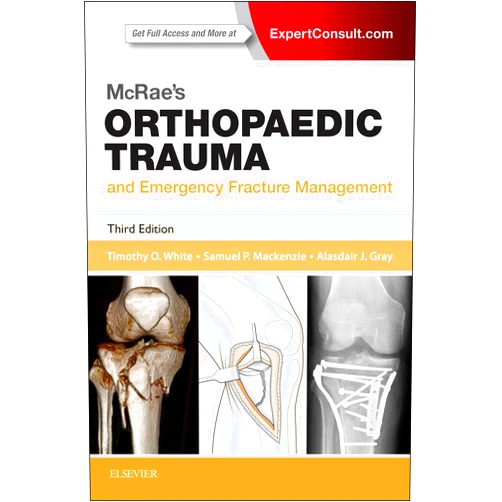 By Timothy O. White BMedSci MBChB FRCSEd (Tr & Orth) MD (Author), Samuel P. Mackenzie BMed Sci MBChB MRCSEd (Author), Alasdair J Gray MBChB FRCS FCEM MD (Author) & 2 more McRae's Orthopaedic Trauma and Emergency Fracture Management