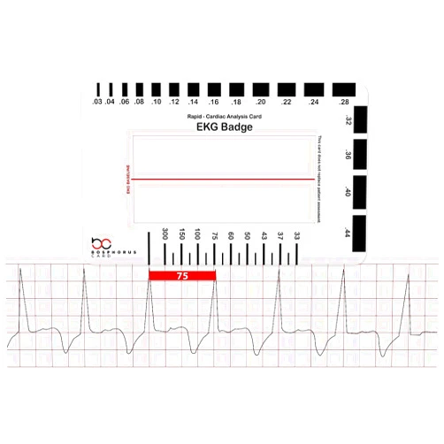 Generic EKG PVC Badge Card – Accurately Interpret ECG/EKG Rhythm Strips and 12 Lead EKG Without EKG Calipers – for Nurse NHS or Anyone in Healthcare!