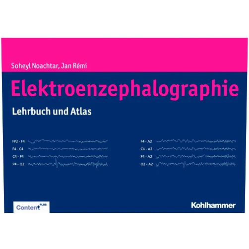 Soheyl Noachtar,Jan Rémi Moderne Elektroenzephalographie - Atlas und Lehrbuch (German Edition)
