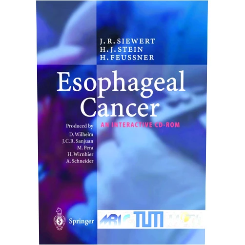 By Jörg Rüdiger Siewert (Author), Hubert J. Stein (Author), Hubertus Feussner (Author) & 0 more Esophageal Cancer