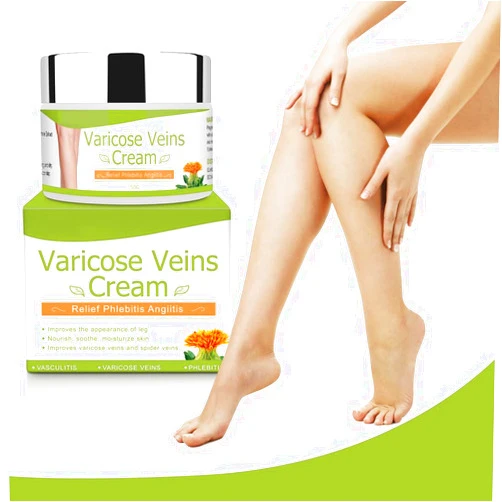 Binoa IDUCEN Body Cream,Varicose Veins Cream, Varicose Veins Treatment for Legs,Varicose Veins Cream for Legs Eliminate Varicose Veins and Spider Veins, Relieve Pain of Legs
