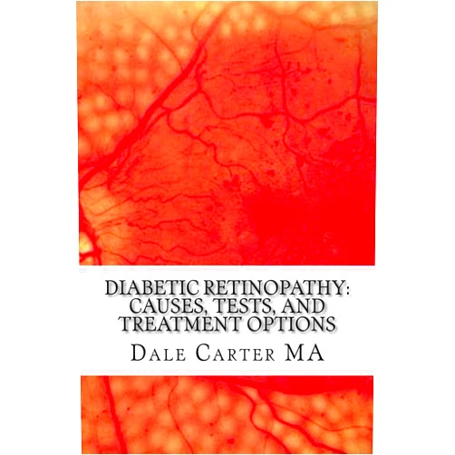 By Dale MA (Author), Edward Montgomery (Editor) Format: Kindle Edition Diabetic Retinopathy: Causes, Tests, and Treatment Options