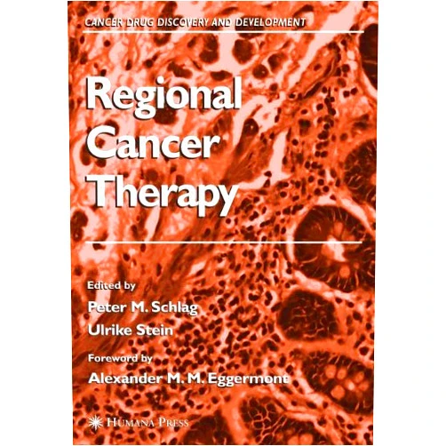 Peter M. Schlag,Ulrike S. Stein,M.M. Eggermont Regional Cancer Therapy (Cancer Drug Discovery and Development)