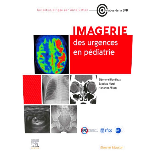 Eléonore Blondiaux,Carole FUMAT,Dominique Duval,Adnan Hassani,Catherine Sembely Taveau,Mélodie Aubart,Volodia Dangouloff-Ros,Monique Elmaleh-Bergès,Margaux BERTRAND,Ève Grangette,Jean-François Chateil,Kévin Beccaria,Charles-Joris Roux,Catherine Adamsbaum,Linda Ouerd,Samia Akkari,Nathalie Boddaert,Adèle Fievet,Marie Blouet,Jean Delmas Delmas,René-Hilaire Priso,Nayla NICOLAS,Solène Ferey,Efraïm Freddy AVNI,Stéphanie Franchi-Abella,David Grévent,Raphaël Levy,Pauline Verpillat,Mohamed El Fayoumi,Catherine Garel,Laurence Rocher,Hervé Brisse,Pierre Bessou,Baptiste Morel,Hubert Ducou Le Pointe,Nathalie Colavolpe,Cécile Herruela-Suffee,Emmanuel Arama,Nathalie Boutry,Solène Le Cam,Charlotte Seiler,Harmony PICO,Alexia Dabadie,Marianne Alison,Catherine Desvignes,Audrey Aschero,Philippe Petit,Saskia Vande Perre,Anne Mathiot,Héloïse Lérisson,Annie Lahoche Manucci,Pierre-Hugues Vivier,Céline Falip,Liesbeth Cardoen,Chantal Durand,Céline Habre,Daniela Rapilat,Meriem Masha BOUMERZOUG Imagerie des urgences en pédiatrie (French Edition)