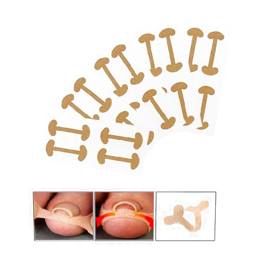EBANKU Ingrown Toenail Treatment Strips, 20 Pcs Toe Nail Correction Patch Elastic Patch Sticker Corrector Pedicure Tools Fingernail Toe Nail Care