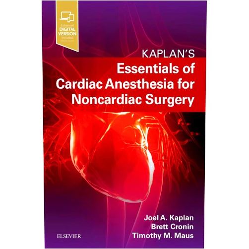 Joel A. Kaplan MD Essentials of Cardiac Anesthesia for Noncardiac Surgery: A Companion to Kaplan's Cardiac Anesthesia