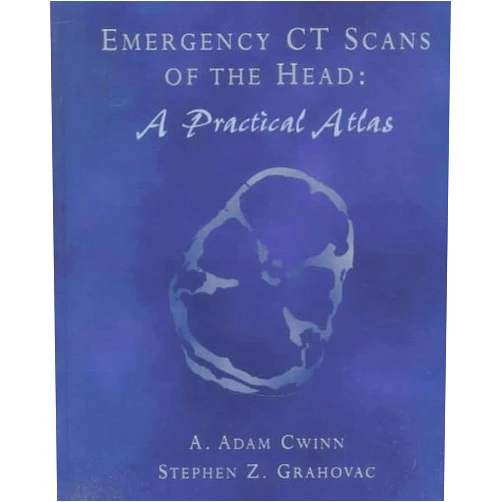By A. Adam Cwinn MD FRCPC (Author), Steven Z. Grahovac MD FRCPC (Author) Emergency CT Scans of the Head: A Practical Atlas