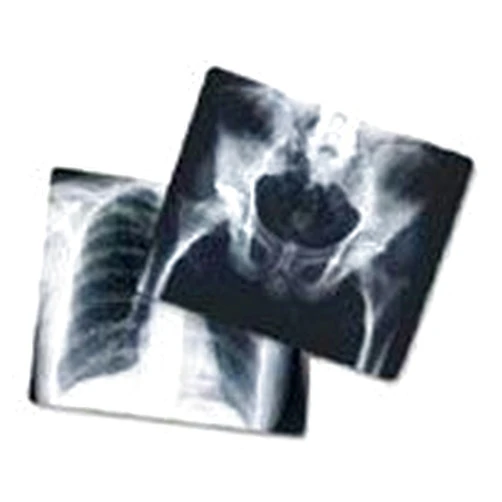 BND- Agfa Corporation 1135669 PT# EBA6A Film X-Ray AGFA 10x12
