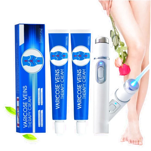 Nosbei Vericose Veins Treatment Blue Light Lazer Treatment Pen, Varicose Veins Blue Light Therapy Set, Blue Light Therapy Pen for Varicose and Spider Veins, Spider Vein Removal Lazer Pen (2cream+1pen)