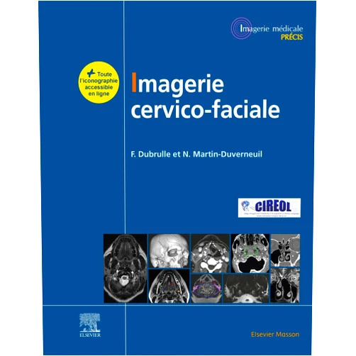French Edition by Frédérique Dubrulle (Author), Nadine Martin-Duverneuil (Author), Marc Tassart (Contributor), Bénédicte Rysman (Contributor), Mélika Amor-Sahli (Contributor), Sophie Périé (Contributor), Mokran BOUKHELIFA (Contributor), Nicolas Daly-Schveitzer (Contributor), Pierre Blanchard (Contributor), Nader-Antoine Sourour (Contributor), Marc Williams (Contributor), Delphine Leclerq (Contributor), Mihaela-Cristina Stephan (Contributor), Loïc Gaillandre (Contributor), Blandine Ruhin (Contributor), Jean-Christophe Gentric (Contributor), Anne-Laure Bocher (Contributor), Jean-Michel Klossek (Contributor), Claire Foirest (Contributor), Raphaëlle Souillard-Scemama (Contributor), Frédéric Tankere (Contributor), Frank Boudghene (Contributor), Thomas Schoumann (Contributor), Claudia Rollia-Bigliani (Contributor), Gérald Bonardel (Contributor), Philippe Meriot (Contributor), Aurélie Drier (Contributor), Jean-Claude Ferrié (Contributor), Jérôme Nevoux (Contributor), Barbara Aupy (Contributor), Ibtissem Radhouani (Contributor), Philippe Halimi (Contributor), François Bidault (Contributor), Michel Cymbalista (Contributor), Farida BENOUDIBA (Contributor), Kévin Premat (Contributor), Eimad Shotar (Contributor), Frédéric Clarençon (Contributor), Xavier Dufour (Contributor), Anne-Laure Gaultier (Contributor), Jean Rousset (Contributor), Dominique Chevalier (Contributor) & 39 more Imagerie cervicofaciale: Massif facial - Sinus - Voies aérodigestives supérieures - Pathologies cervicales - Espaces profonds de la face (French Edition)