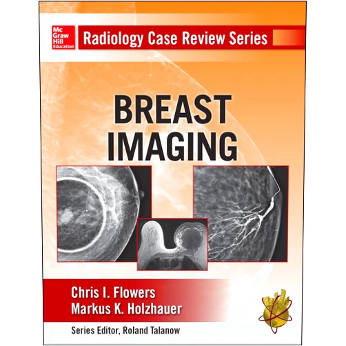 Chris Flowers,Markus Holzhauer Radiology Case Review Series: Breast Imaging