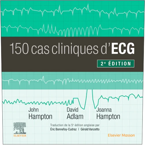 French Edition by David Adlam (Author), Joanna Hampton (Author), John R. Hampton (Author), Claire GUILABERT (Editor), Gérald Vanzetto (Translator), Eric Bonnefoy-Cudraz (Translator) & 2 more Format: Kindle Edition 150 cas cliniques d'ECG (French Edition)