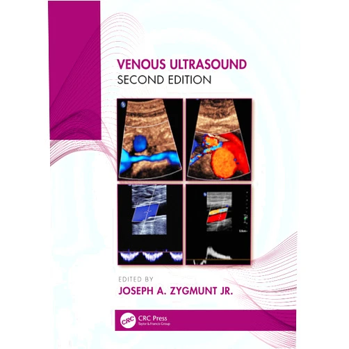 Joseph A. Zygmunt Jr. Venous Ultrasound