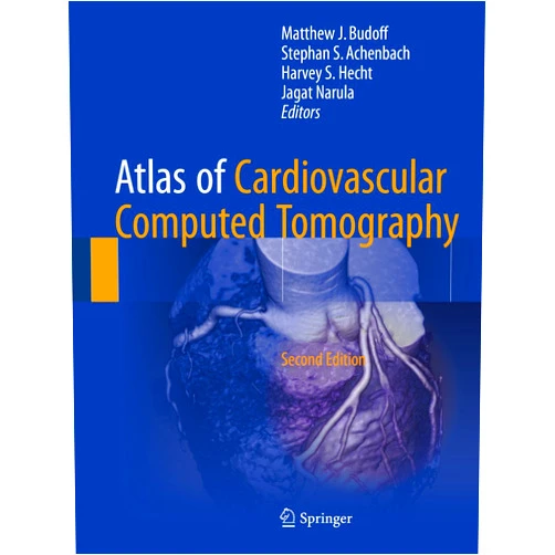 Matthew J. Budoff,Stephan S. Achenbach,Harvey S. Hecht,Jagat Narula Atlas of Cardiovascular Computed Tomography