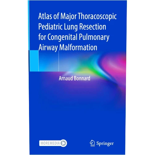 By Arnaud Bonnard (Author) Format: Kindle Edition Atlas of Major Thoracoscopic Pediatric Lung Resection for Congenital Pulmonary Airway Malformation