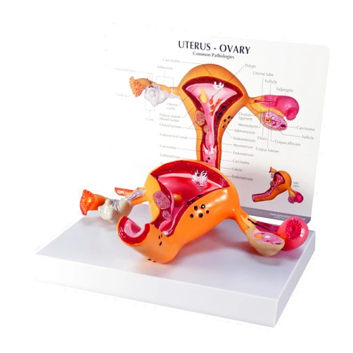GPI Anatomicals - Uterus and Ovary Model, Model of Female Reproductive System for Human Anatomy and Physiology Education, Anatomy Model for Doctor's Office and Classrooms, Medical Learning Resources