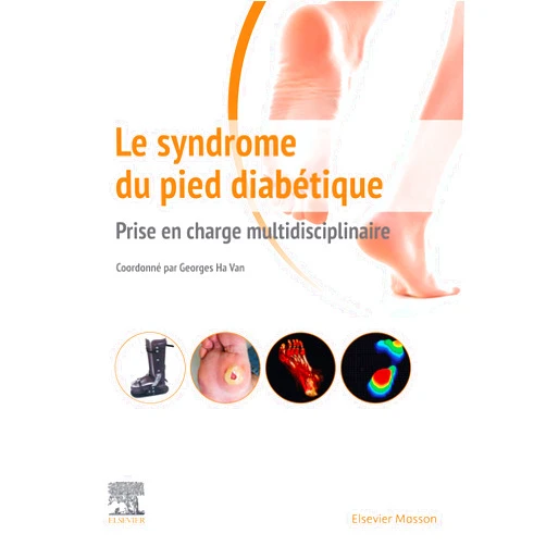French Edition by Georges Ha Van (Author), Cyrille MARTINET (Illustrator), Kristien Van Acker (Foreword), Thibault Couture (Contributor), Franck Phan (Contributor), Sébastien Hains (Contributor), Isabelle Dumont (Contributor), Viviane Quiniou (Contributor), Quentin Monzani (Contributor), Yves Bensimon (Contributor), Eric Fourniols (Contributor), Jacques Martini (Contributor), Agnès Hartemann (Contributor), Doan Vu Tri (Contributor), Marc Lepeut (Contributor), S. Schuldiner (Contributor), Véronique Labbe-Gentils (Contributor), Jean Savin (Contributor), Antoine Perrier (Contributor), Eric Senneville (Contributor), Julien Vouillarmet (Contributor), Jérôme Haddad (Contributor), Julien Gaudric (Contributor), Gérard Chiesa (Contributor) & 21 more Format: Kindle Edition Le syndrome du pied diabétique: Prise en charge multidisciplinaire (Hors collection) (French Edition)
