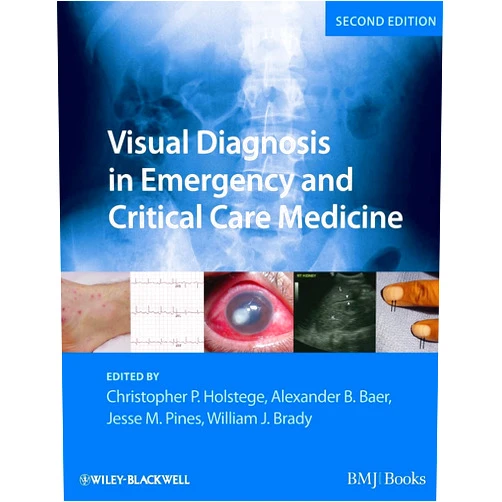 Christopher P. Holstege,Alexander B. Baer,Jesse M. Pines,William J. Brady Visual Diagnosis in Emergency and Critical Care Medicine