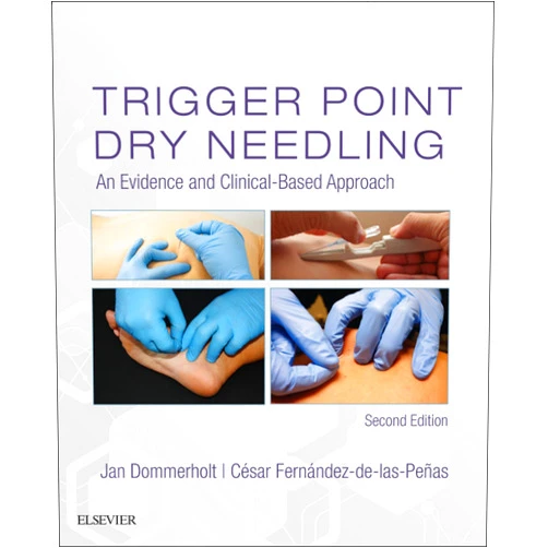 By Jan Dommerholt (Editor), Cesar Fernandez de las Penas (Editor) Format: Kindle Edition Trigger Point Dry Needling E-Book
