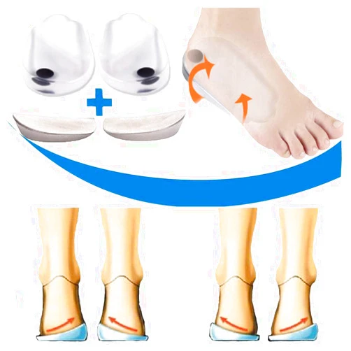 Mcvcoyh Orthopedic Insoles for Correcting O/X Type Leg Shoe Inserts, Built in Magnetic Heel Shoe Cushions for Foot Alignment, Knock Knee Pain, Bow Legs- 2 Pairs