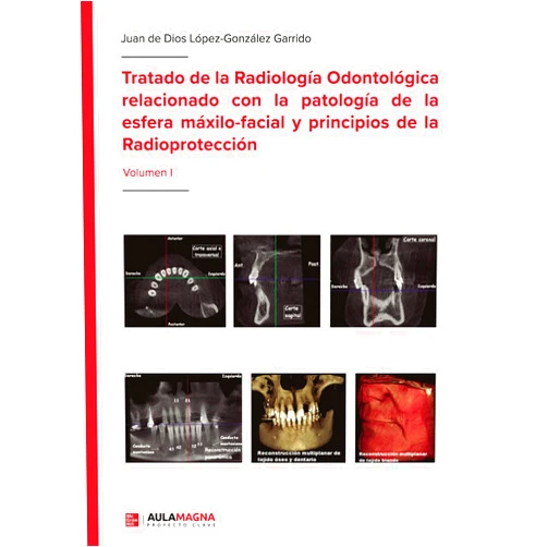 Spanish Edition by Juan de Dios López-González Garrido (Author) Format: Kindle Edition Tratado de la Radiología Odontológica relacionado con la patología de la esfera máxilo-facial y principios de la Radioprotección: Volumen I (Spanish Edition)