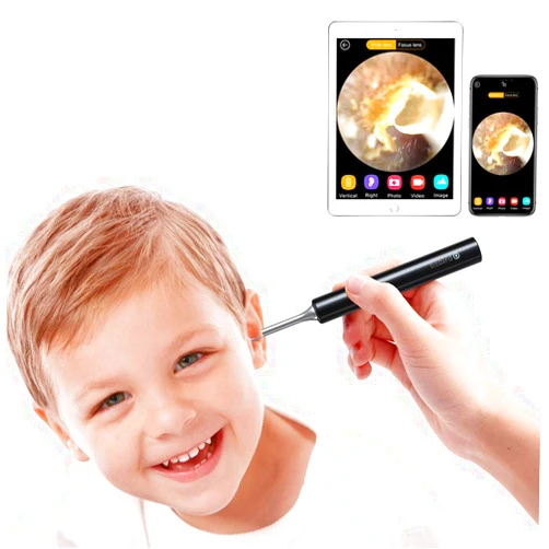 Hmount Ear Wax Removal Tool, Ear Wax Removal Endoscope, Super Light Lens WiFi Ear Endoscope with 6 LED Lights, 080P FHD Wireless Ear Otoscope Camera with 3-Axis Gyroscope, Black