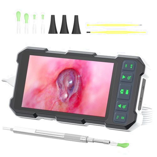 QzkBoeo Ear Camera Otoscope, Digital Otoscope with 4.5