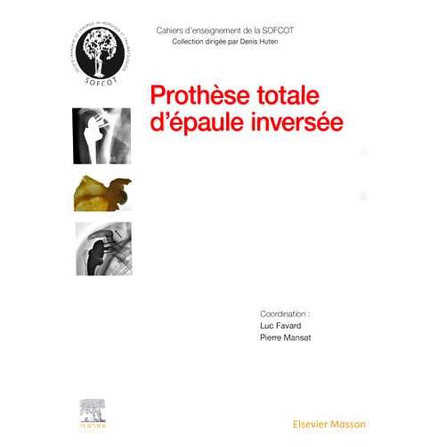 By Luc Favard (Author), Pierre Mansat (Author), SOFCOT (Author), Cyrille MARTINET (Illustrator), Lionel Neyton (Contributor), Marlen EGGER (Contributor), Stéphane CORNEC (Contributor), Adrien Jacquot (Contributor), Philippe Teissier (Contributor), Jean-David Werthel (Contributor), Cécile Nérot (Contributor), Clément Spiry (Contributor), Christophe Lévigne (Contributor), Matthieu Mazaleyrat (Contributor), Alain Farron (Contributor), S. Gain (Contributor), Jacques Teissier (Contributor), David Gallinet (Contributor), Thierry Joudet (Contributor), Mickael Chelli (Contributor), Philippe Collotte (Contributor), Philippe Collin (Contributor), Lotte Verstuyft (Contributor), René Verdonk (Contributor), Emmanuel Baulot (Contributor), Alexandre Lädermann (Contributor), Marc-Olivier Gauci (Contributor), Anthony HERVE (Contributor), Timon Meynard (Contributor), Philippe Clavert (Contributor), Jean-François Gonzalez (Contributor), Alexandre Tronchot (Contributor), Lisa Peduzzi (Contributor), Pierre-Henri Flurin (Contributor), Nicolas Bonnevialle (Contributor), M. Ferrand (Contributor), Gilles Walch (Contributor), Lieven De Wilde (Contributor), Pascal Boileau (Contributor), Philippe Valenti (Contributor), François Sirveaux (Contributor), Alexandre Terrier (Contributor), Hervé Thomazeau (Contributor), Julien Berhouet (Contributor), L. Baverel (Contributor) & 41 more Format: Kindle Edition Prothèse totale d'épaule inversée (Cahiers d'enseignement de la SOFCOT)