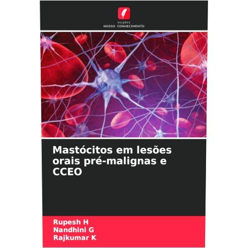 Rupesh H,Nandhini G,Rajkumar K Mastócitos em lesões orais pré-malignas e CCEO (Portuguese Edition)