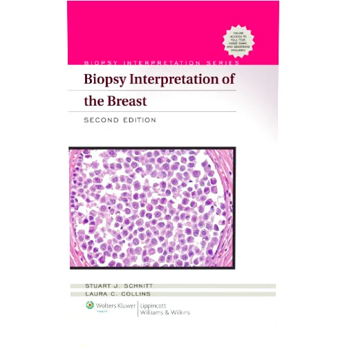 Stuart J. Schnitt,Laura C. Collins Biopsy Interpretation of the Breast (Biopsy Interpretation Series)