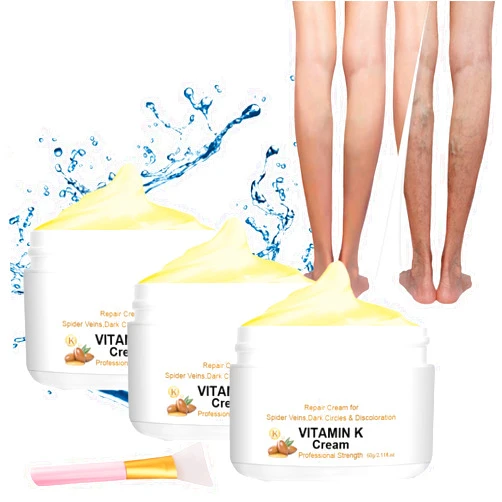 FACECOI Vitamin K Cream, Varicose Veins Miracle Cream, Spider Varicose Veins Miracle Cream, Remove Varicose Veins for Legs (3pcs)