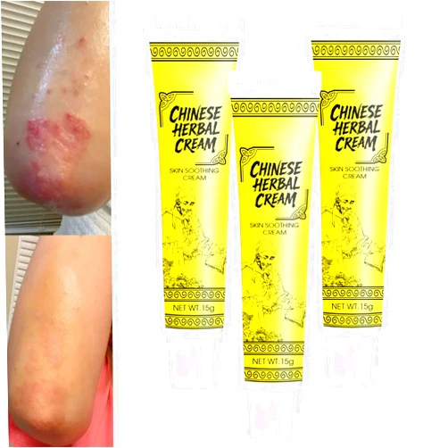Generic Smiles and Joys Herbal Cream, East Asian Natural Herbal Cream, Herbals Ointment for Natural Relief of Skin Problems for All Skin Types